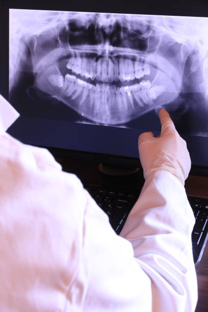 Best Emergency Dental Care for Broken or Chipped Teeth in Galveston, IN